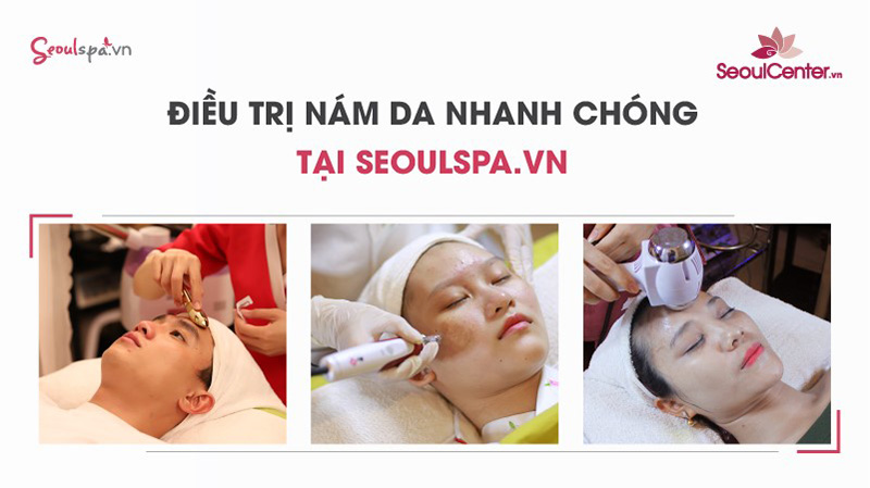 Liệu trình loại bỏ nám da phong phú và đa dạng
