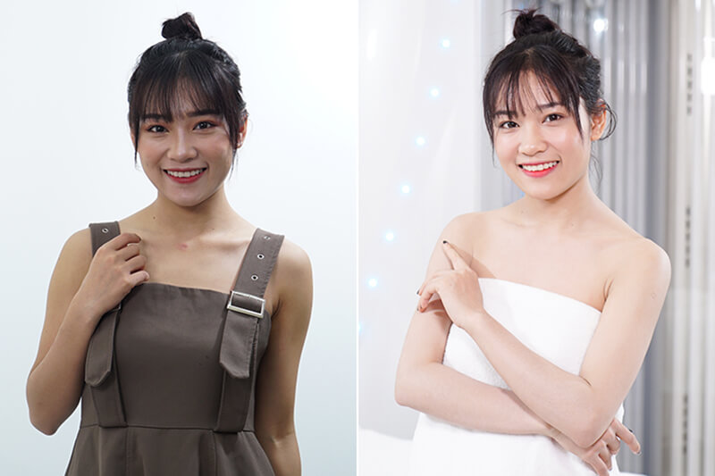 Hình ảnh khách hàng trước và sau khi tắm trắng phi thuyền tại Thẩm mỹ viện Seoul Spa