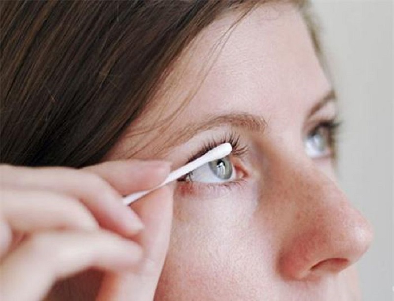 Top 20+ Cắt Mí Mắt Kiêng Ăn Gì Trong Bao Lâu Xăm mí mắt kiêng ăn gì? Những lưu ý sau khi xăm mí mắt | SeoulSpa.Vn 49 Dùng tăm bông để vệ sinh mắt