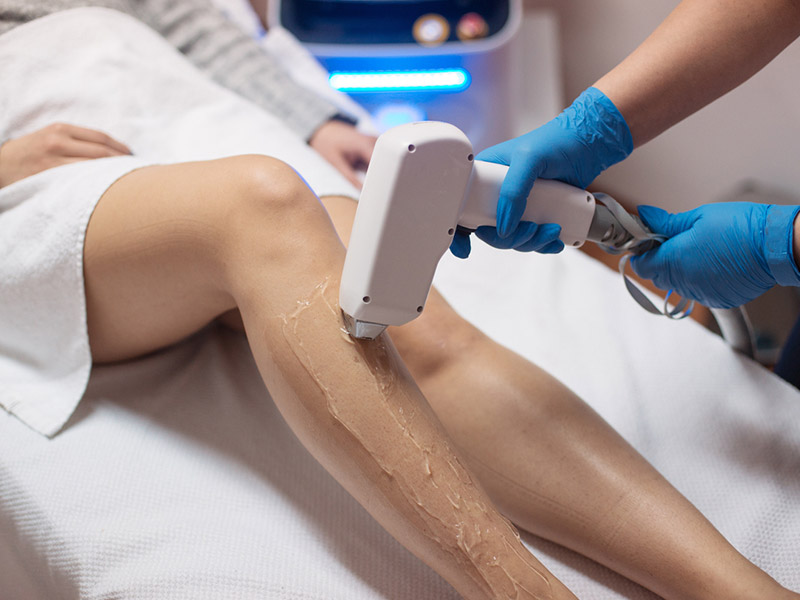 Triệt lông có hết không sẽ phụ thuộc vào cơ địa và phương pháp bạn lựa chọn