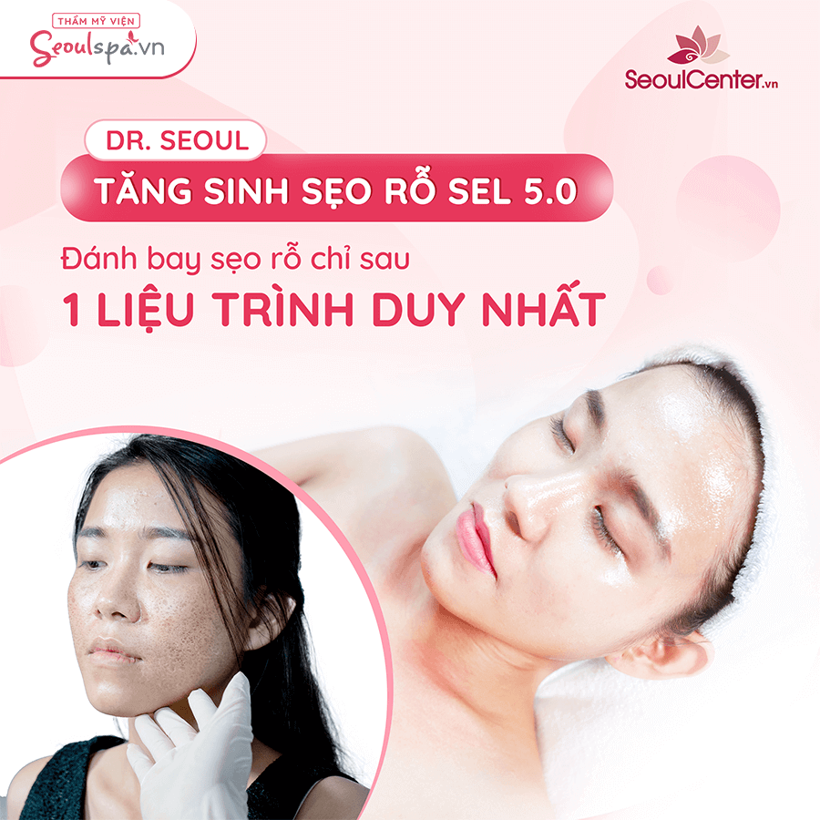Top 20+ Co Ai Tri Seo Ro O Doctor Scar Chua DR. Seoul Trị Sẹo Rỗ SEL 5.0 - Điều trị tận gốc sẹo cam kết không tái lại 26 Tiến sĩ điều trị dứt điểm sẹo rỗ chỉ sau 1 liệu trình. Seoul SEL 5.0