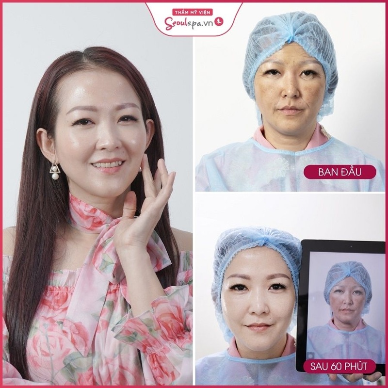 Thẩm mỹ viện Seoul Spa là địa chỉ căng chỉ da mặt an toàn, uy tín và hiện đại