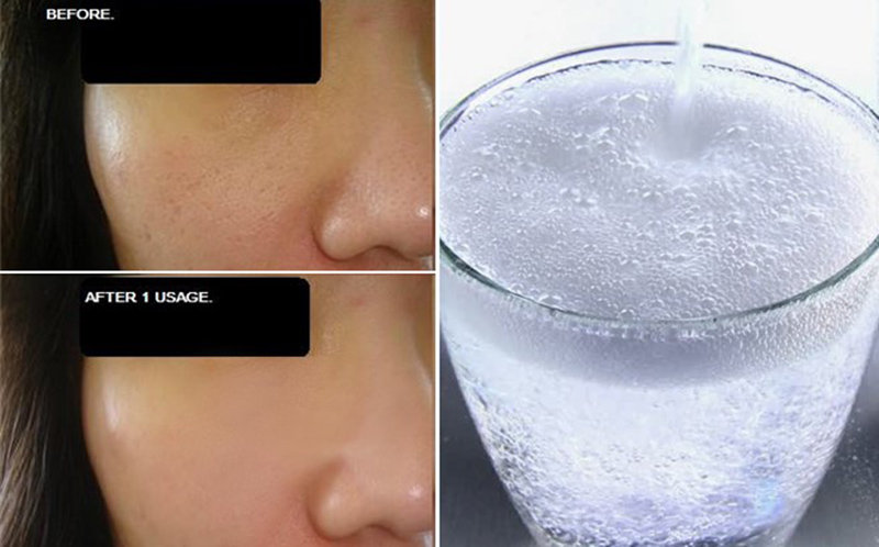 Top 20+ Uống Nước Khoáng Có Ga Có Tốt Không Rửa mặt bằng nước khoáng có ga có an toàn và hiệu quả? 32 Chọn Sản Phẩm Nước Khoáng Có Ga Phù Hợp
