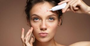 Việc mua lẻ nhiều sản phẩm sẽ dẫn đến tình trạng thừa sản phẩm điều trị không cần thiết