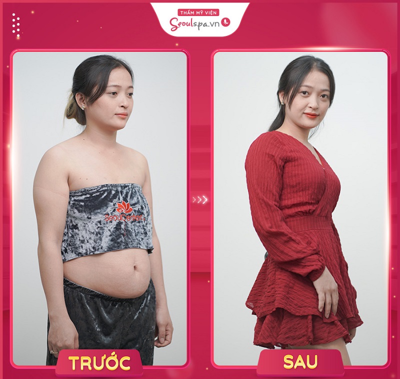 Seoul Spa là địa chỉ giảm mỡ cơ thể nhanh chóng, hiệu quả