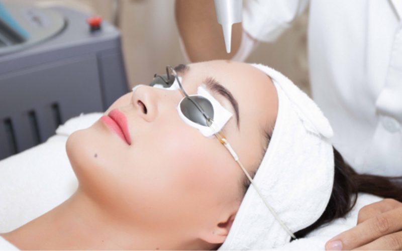 Trẻ hóa da bằng laser là phương pháp làm đẹp an toàn nhất hiện nay