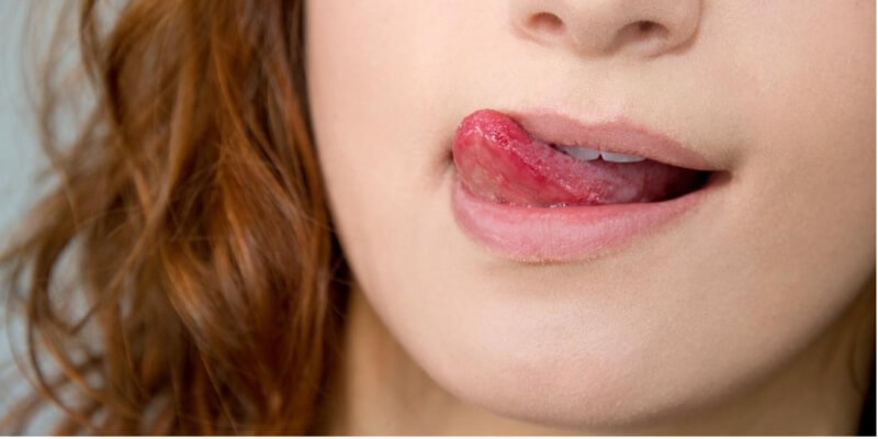 Liếm môi sẽ khiến môi bị thâm, khô do đó bạn nên tránh thói quen này