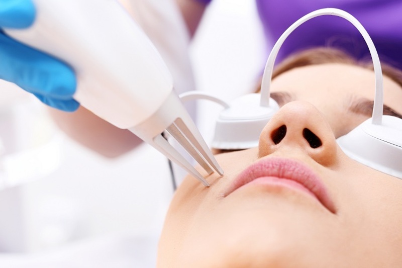 Công nghệ trị mụn Laser CO2 Fractional giúp da trắng sáng, chắc khỏe