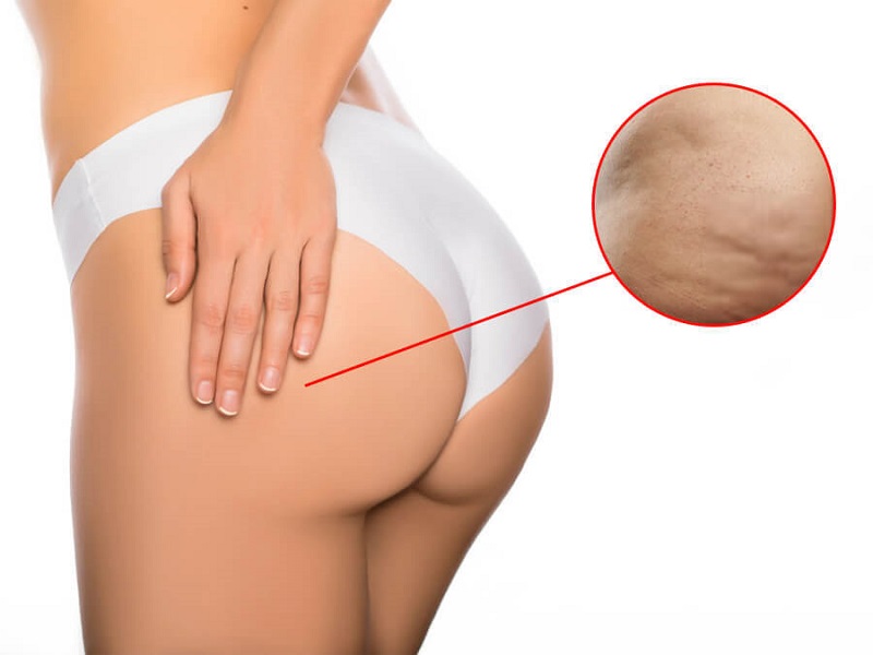 Nhẹ nhàng với làn da mông khi vệ sinh và làm sạch