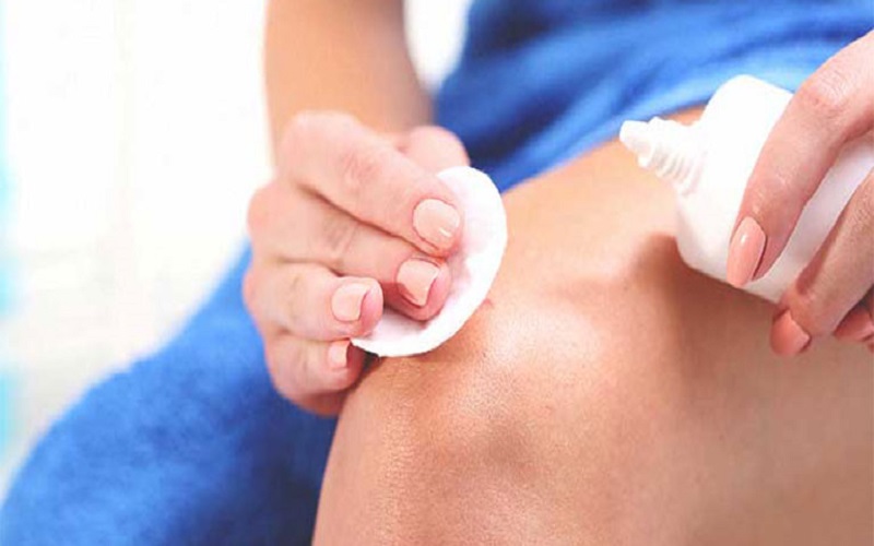 Chăm sóc vết thương hở, bị côn trùng đốt kỹ để tránh bị mụn nhọt