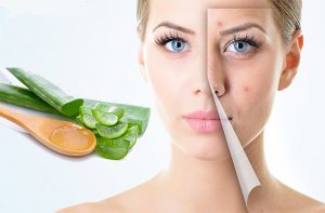 Cách trị mụn ở tuổi 12, 13, 14 an toàn và phù hợp với lứa tuổi 21 Rau diếp cá