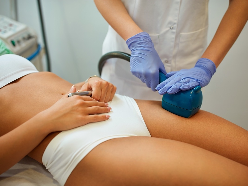 Chữa rạn da bằng phương pháp siêu mài mòn là một trong những phát hiện y khoa mới