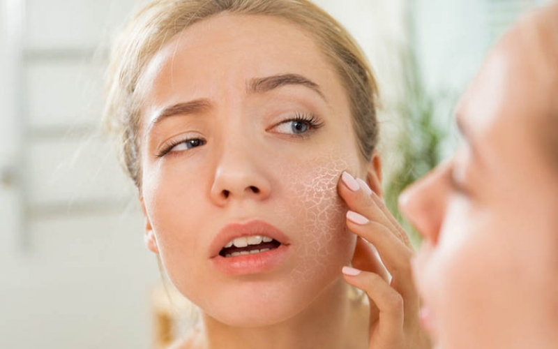 Cách trị da rắn bẩm sinh tại nhà