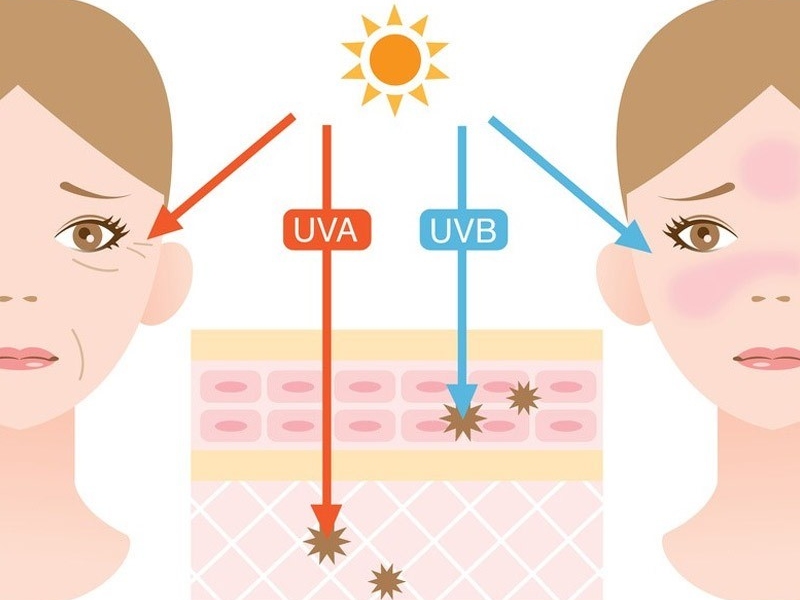 Ánh nắng Mặt Trời có tác động rất lớn đến sự lão hóa và hình thành nếp nhăn nơi cố