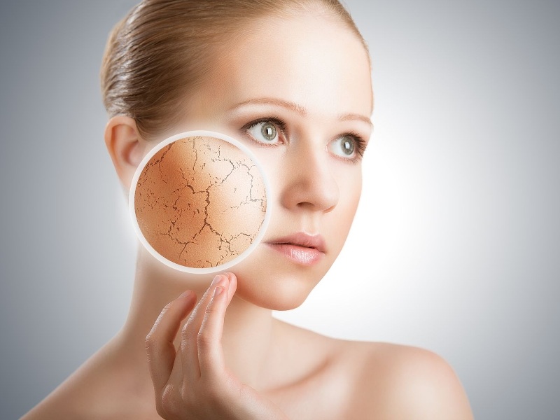 Những ai nên thực hiện căng chỉ collagen