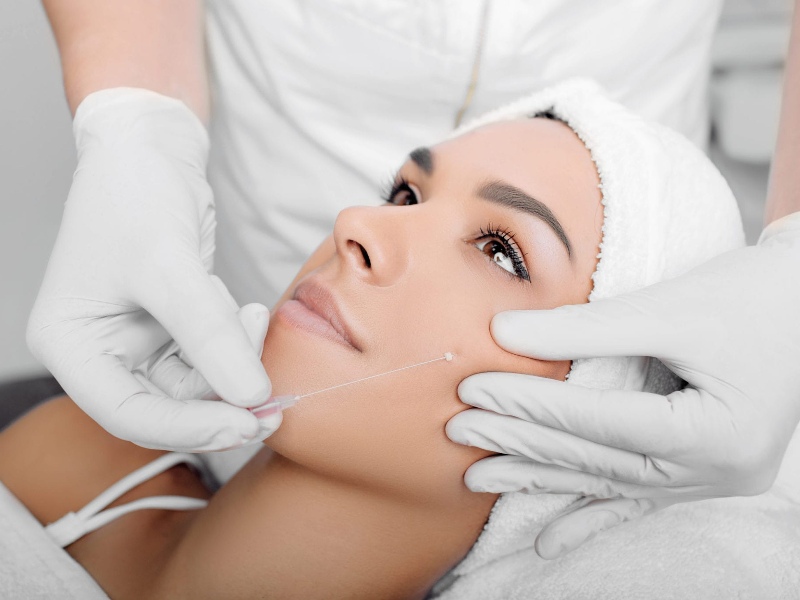 Phụ nữ sau 30 tuổi hoặc những người có dấu hiệu lão hóa sớm nên căng chỉ collagen