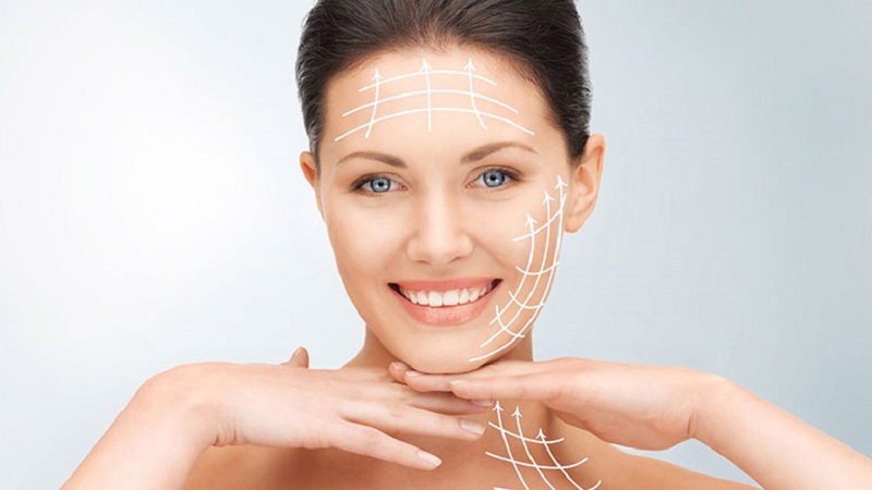 Ưu điểm của phương pháp căng da mặt bằng chỉ