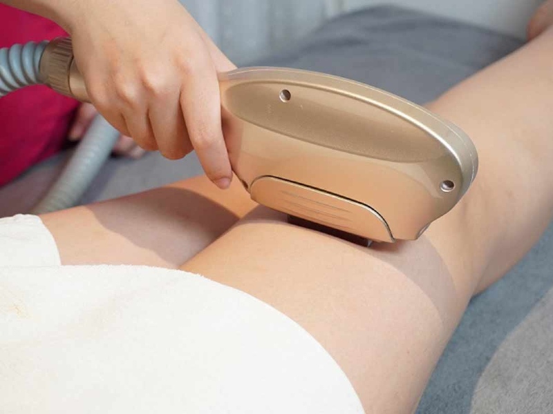 Công nghệ triệt lông Elight
