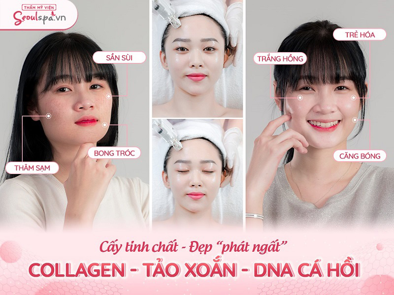 Dịch vụ chăm sóc da tại Seoul Spa