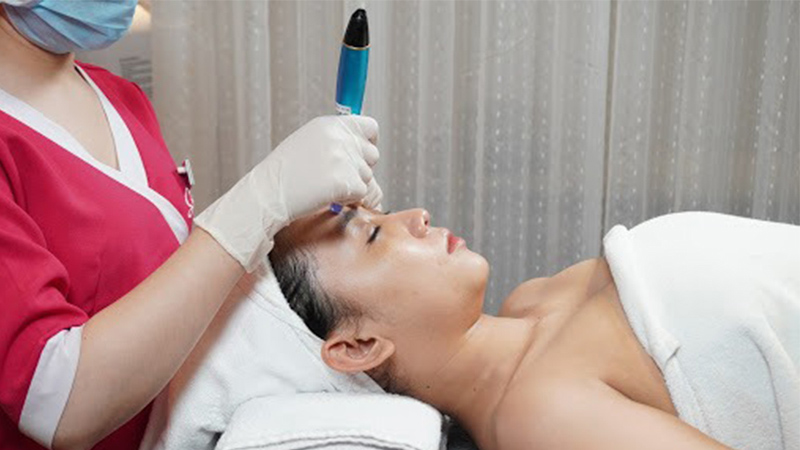Trị mụn bằng laser bao nhiêu tiền?