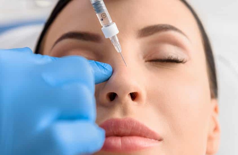 Tiêm filler ở mũi là phương pháp được nhiều chị em sử dụng hiện nay