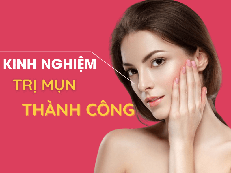 Một số kinh nghiệm trị mụn thành công nhất