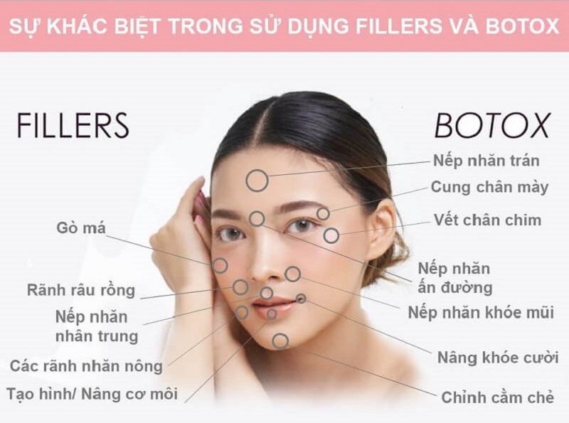 Sự khác nhau giữa Filler và Botox