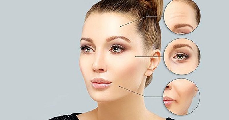 Khi tiêm Botox vào vùng trán, đuôi mắt, khóe môi nó sẽ làm giúp xóa nếp nhăn động