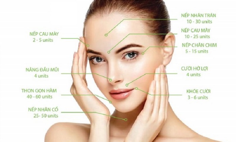 Những trường hợp nên tiêm Botox