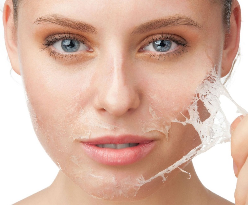 Sau khi tiêm Botox nên ngừng các phương pháp lột tẩy da mạnh