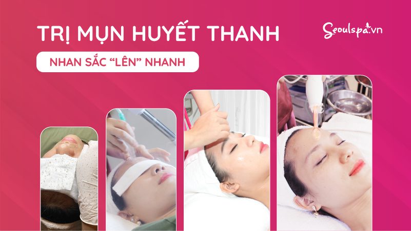 Trị mụn huyết thanh tảo biển làm sạch mụn lên đến 90% ngay từ lần đầu tiên