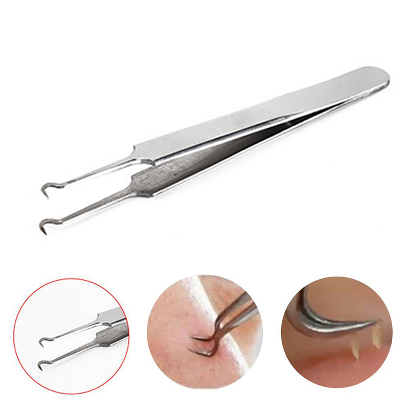 Nhíp nặn mụn giúp lấy nhân mụn nhanh chóng