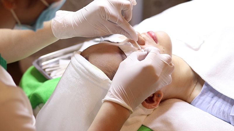 Nặn mụn tại cơ sở uy tín an toàn và tốt hơn cho làn da
