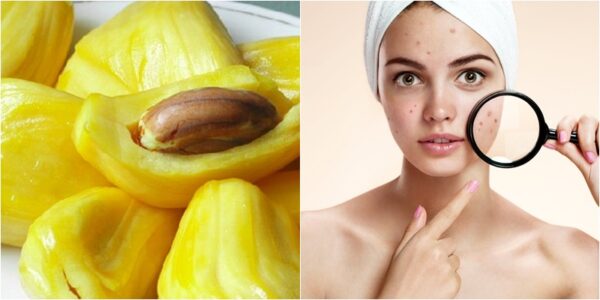 Mít có khả năng gây nóng cho cơ thể vì chứa rất nồng độ đường rất cao