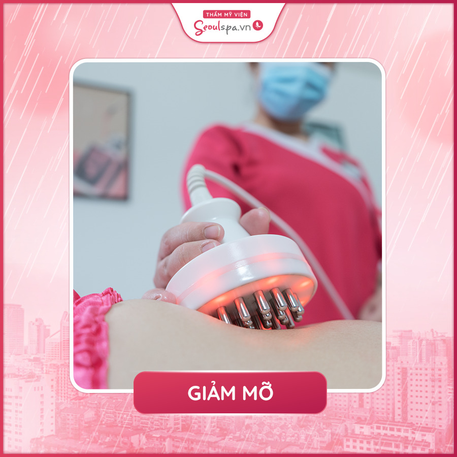 Công nghệ giảm béo Smart Lipo 4S ứng dụng 4 đầu máy đánh tan mỡ thừa