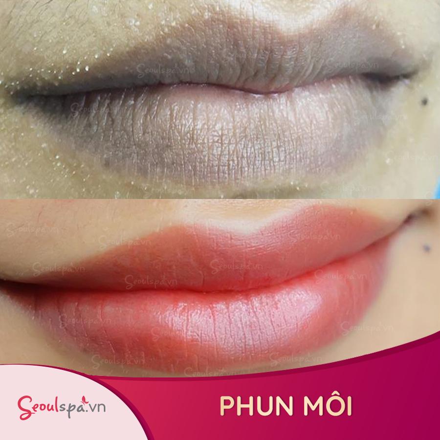 Top 20+ Xăm Môi Kiêng Rau Muống Bao Lâu Sau phun môi kiêng rau muống bao lâu? Nên ăn loại rau nào? 21 Phun sương môi tiêu chuẩn của Seoul Spa hoạt động rất đẹp