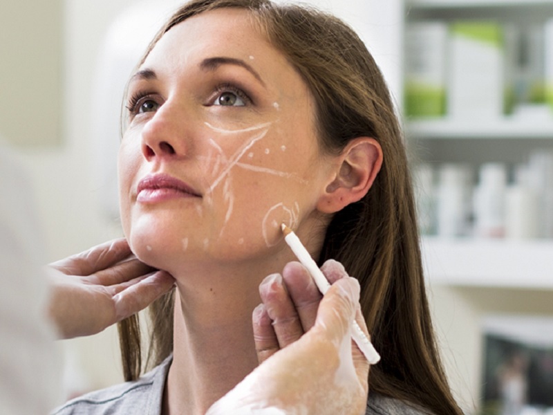 Top 20+ Những Điều Cần Biết Khi Tiêm Filler Tiêm filler là gì? Những vấn đề cần biết trước khi tiêm 23 Bạn sẽ cần tiêm nhắc lại sau 6-18 tháng để duy trì hiệu quả của chất làm đầy