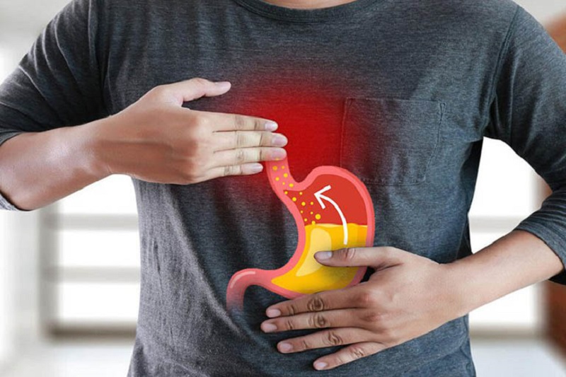 Top 20+ Tác Dụng Của Hành Tây Đối Với Da Mặt Hành tây bao nhiêu calo? Ăn hành tây có giảm cân không? 45 Ăn hành tây có thể gây trào ngược axit dạ dày