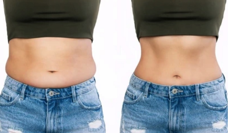 Top 20+ Tác Dụng Của Hành Tây Đối Với Da Mặt Hành tây bao nhiêu calo? Ăn hành tây có giảm cân không? 33 Hành tây có chứa prebiotic giúp hỗ trợ giảm mỡ bụng