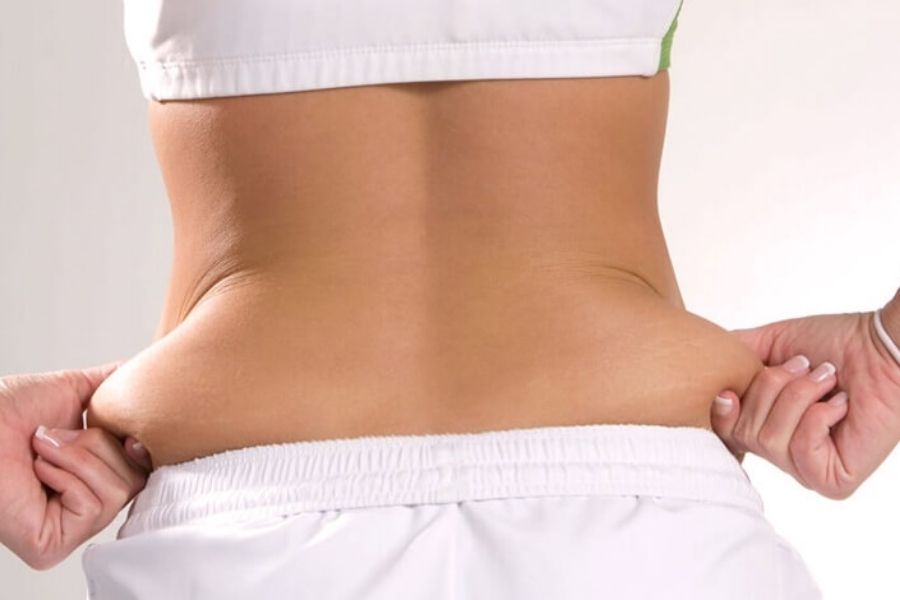 Không phải đối tượng nào cũng có thể thực hiện hút mỡ bụng