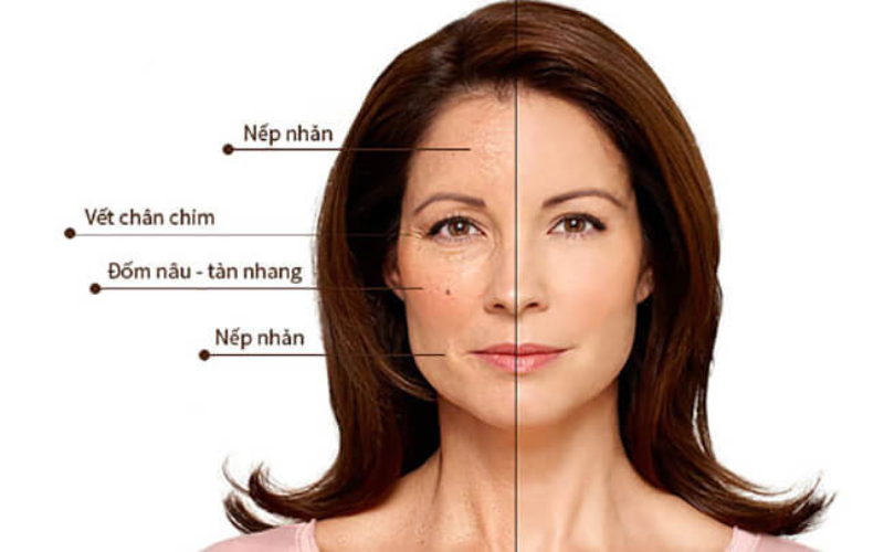Trẻ hóa da là phương pháp đẩy lùi dấu hiệu lão hóa hiệu quả