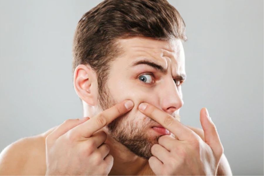 Nam giới vệ sinh da mặt không đúng cách cũng là nguyên nhân gây ra mụn