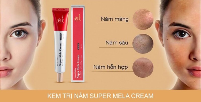 Sản phẩm kem trị nám của thương hiệu From Your Skin có thể cải thiện nám vượt trội trong 90 ngày