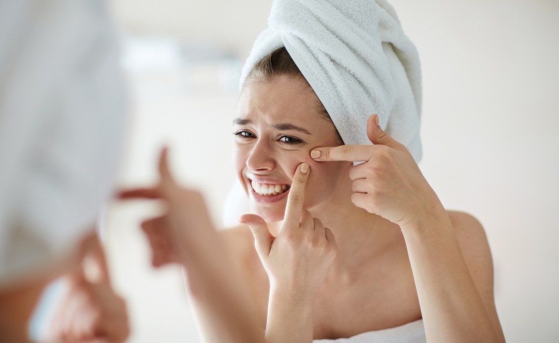 Mụn luôn là nỗi ám ảnh không của riêng ai