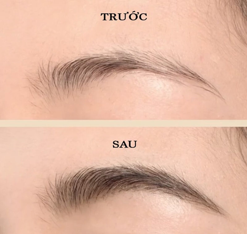 Kết quả sau khi cấy lông mày