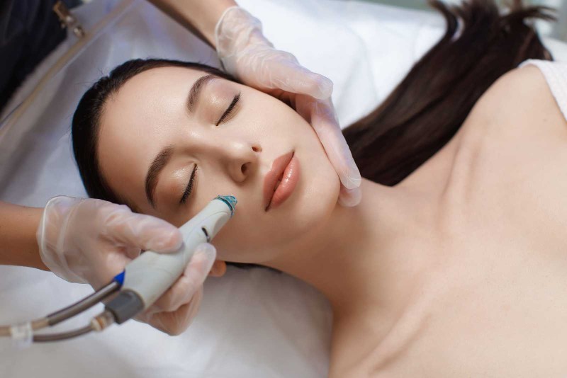 Trị mụn dứt điểm bằng việc sử dụng máy hút mụn