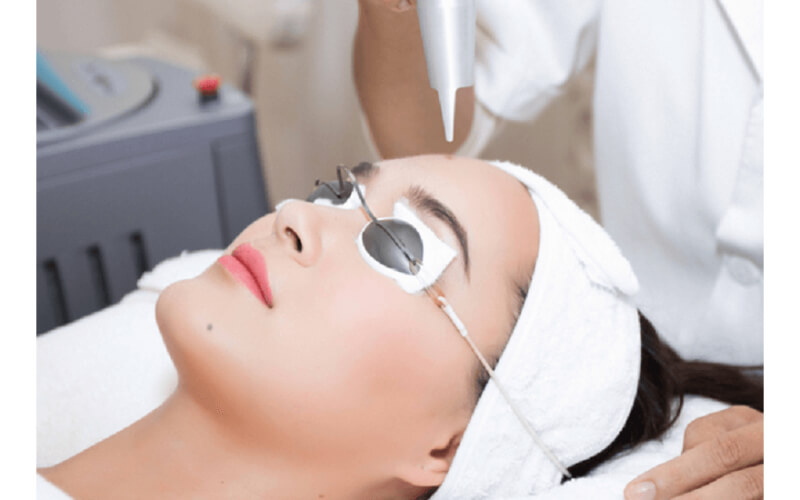 Seoul Spa là địa chỉ cung cấp dịch vụ điều trị mụn cơm uy tín hiện nay