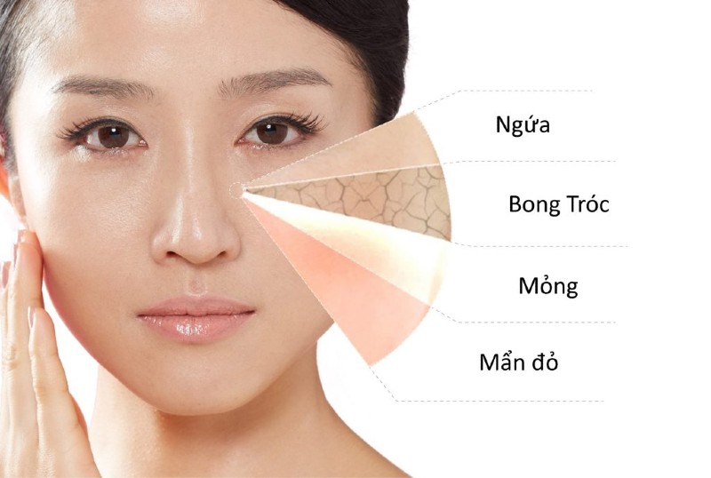 Top 20+ Kim Beauty Trị Mụn Có Tốt Không Top 10 spa trị mụn Gò Vấp uy tín, chất lượng và hiệu quả tốt nhất 41 Bạn nên nắm rõ được tình trạng da của mình trước khi trị mụn