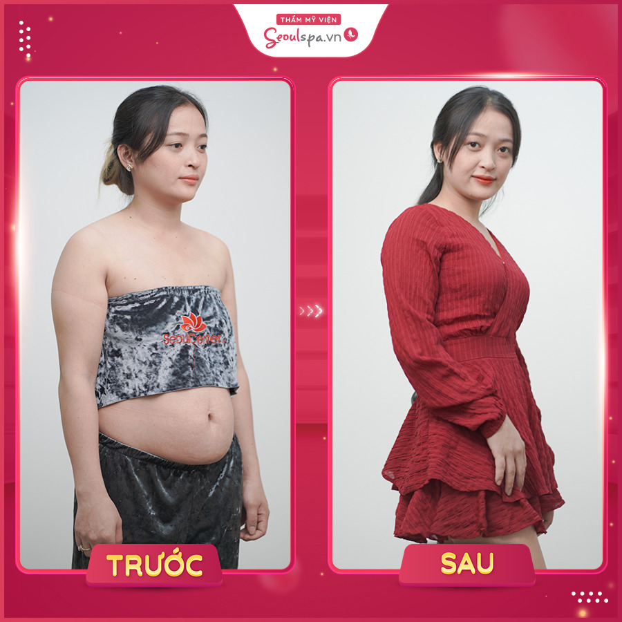 Top 20+ Uống Nước Hoa Đậu Biếc Có Tác Dụng Gì Cách pha trà hoa đậu biếc giảm cân hiệu quả và nhanh chóng ngay tại nhà 45 Seoul Spa mang giải pháp giảm cân hiện đại hàng đầu cho khách hàng