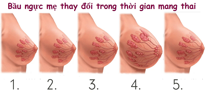 Tình trạng hormone progesterone thay đổi khiến bầu ngực của mẹ bầu cũng thay đổi